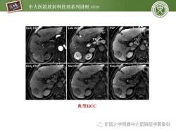 造影术：利用放射性、对比剂等技术的影像诊断方法