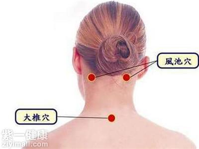 中医放血治疗：疏通经络、缓解疼痛、退热的自然疗法