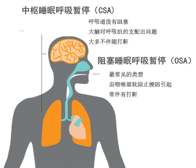 呼吸不畅：可能的原因及治疗方法