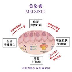 告别妊娠纹！热敷、激光与药物的全方位去除指南