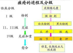 鼻子痤疮成因解析：激素、油脂与青春期的纠缠