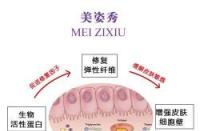 告别妊娠纹！热敷、激光与药物的全方位去除指南