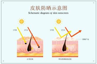 黄褐斑治疗费用：影响因素与合理预期