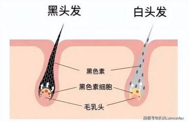 白发产生的原因及调理方法：乌发养颜茶和黑发食物的保健功效