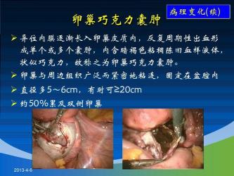 巧克力囊肿：子宫内膜异位引发的疾病及预防